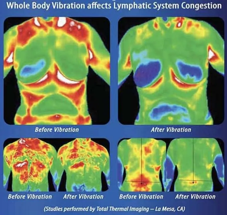 Lymphatic system whole body vibration science thermal imaging